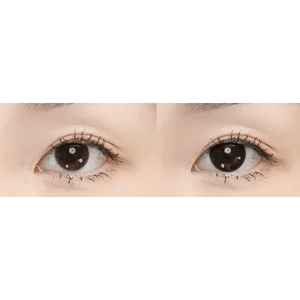 アンド ブラック And Black - Idol Karakon