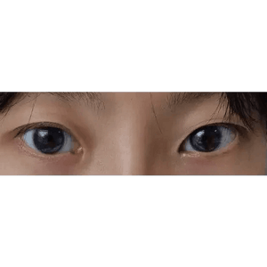 LensRang iWWi Narcissus Blue - Idol Karakon